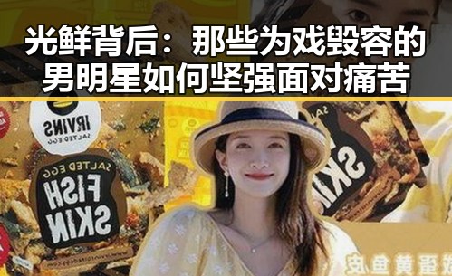 光鲜背后:那些为戏毁容的男明星如何坚强面对痛苦